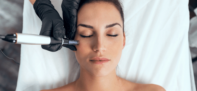 Microneedling para estimular colágeno y mejorar textura